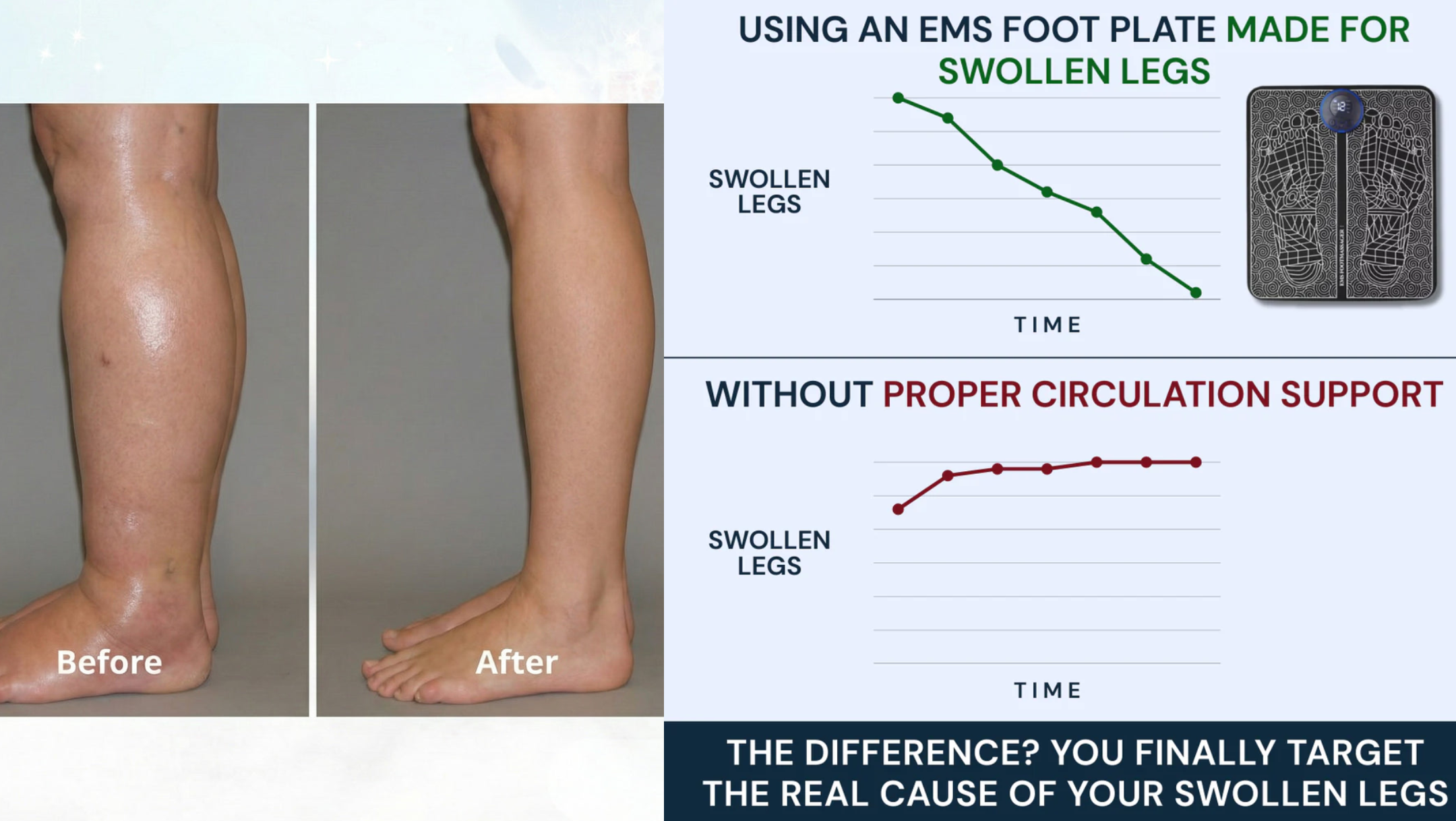 showing benefit of ornexis ems foot plate